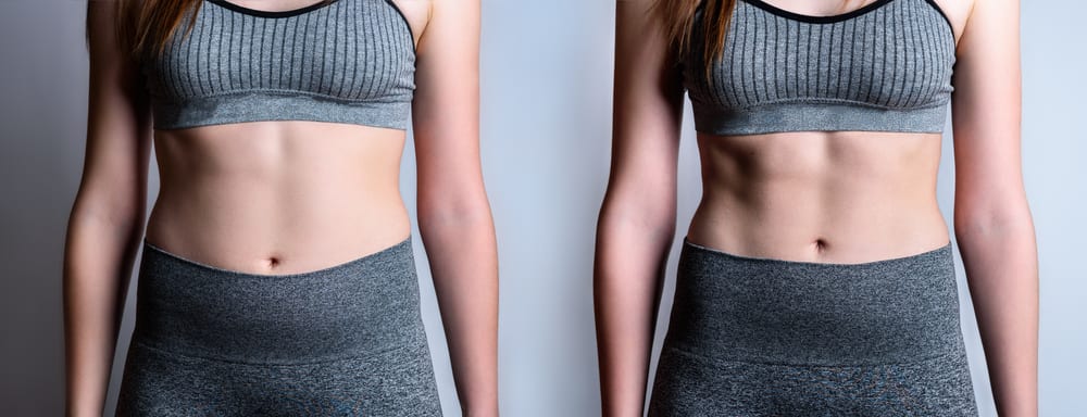 EmsculptNEO body sculpting treatment near Marina del Rey Los Angeles