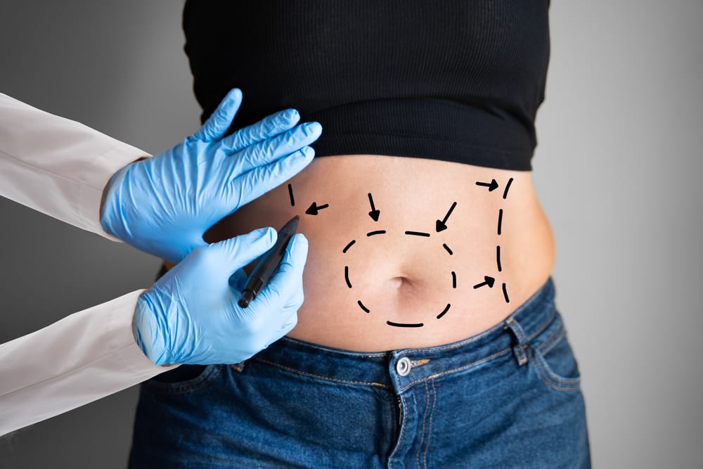 Body contouring treatment near Marina del Rey Los Angeles