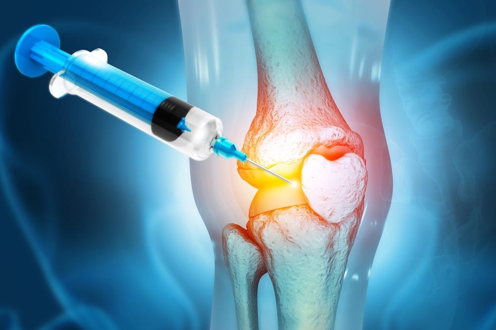 Stem cell regenerative therapy in Los Angeles 90045
