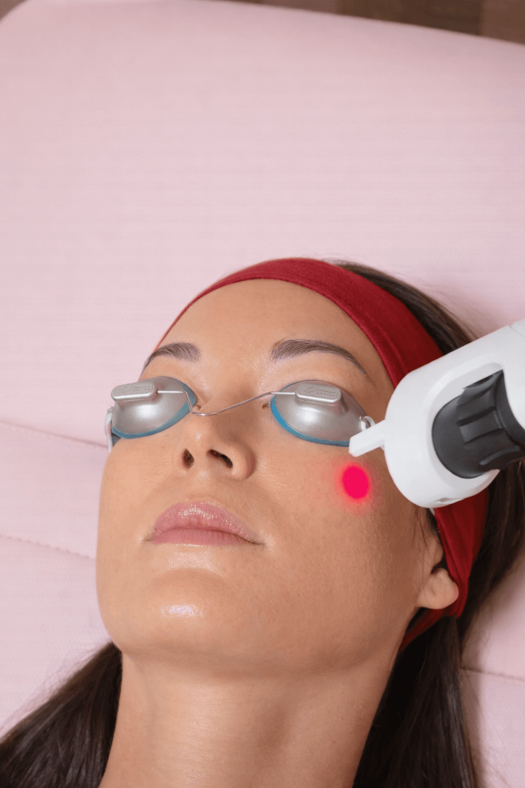 Laser skin treatment Lumenis IPL ResurFX near Westchester Los Angeles 90045