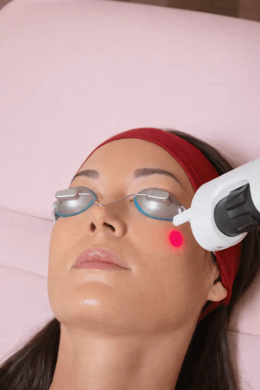 Laser skin treatment Lumenis IPL ResurFX near Westchester Los Angeles 90045