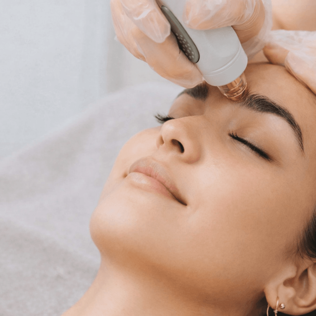 Radiofrequency skin therapy near Playa Vista Los Angeles