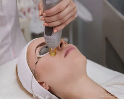TempSure eye treatment for wrinkles near Playa Vista Los Angeles