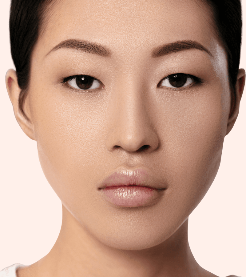 Botox lip flip treatable lip areas in Westchester Los Angeles