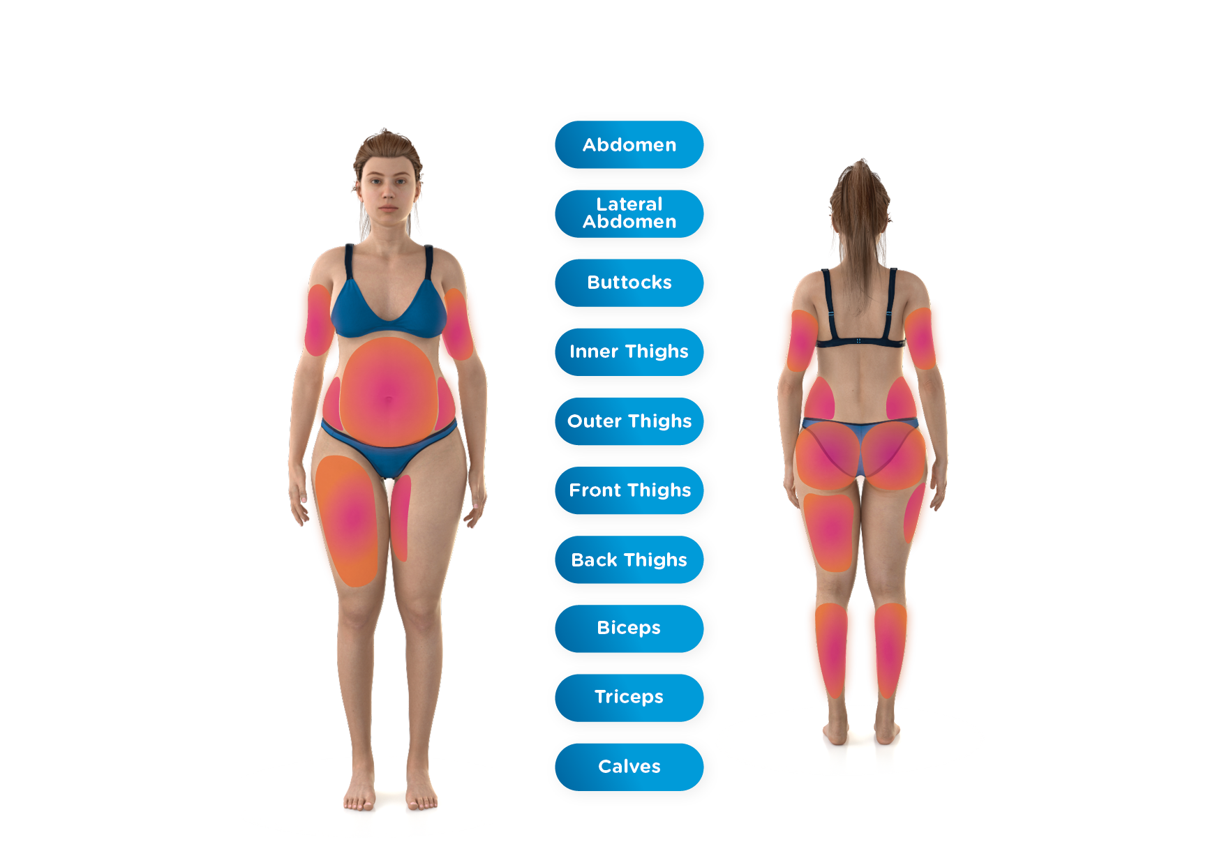 EmsculptNEO treatable body areas near Playa Vista Los Angeles