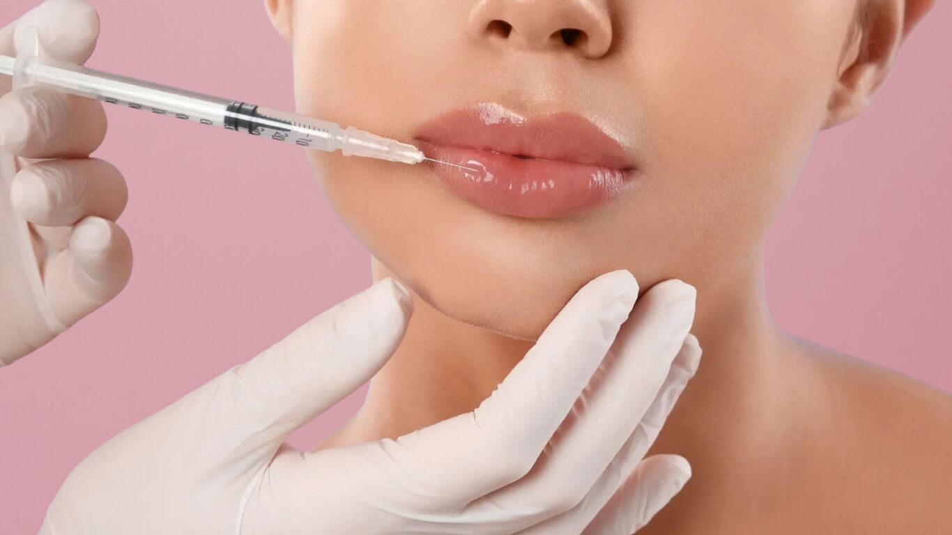 Lip filler consultation for a patient near Marina del Rey