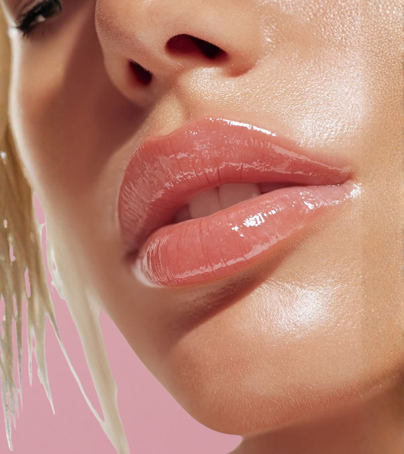 Lip filler treatment results at Total Body Aesthetic med spa Los Angeles