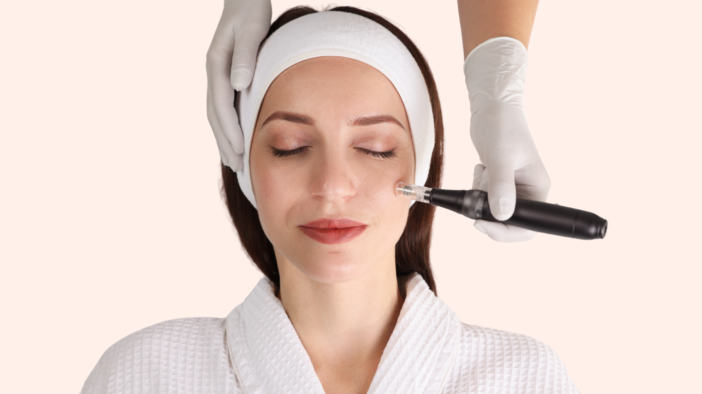 Microneedling treatment at Total Body Aesthetic med spa Los Angeles