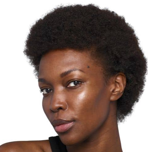 After SkinVive treatment results near Marina del Rey