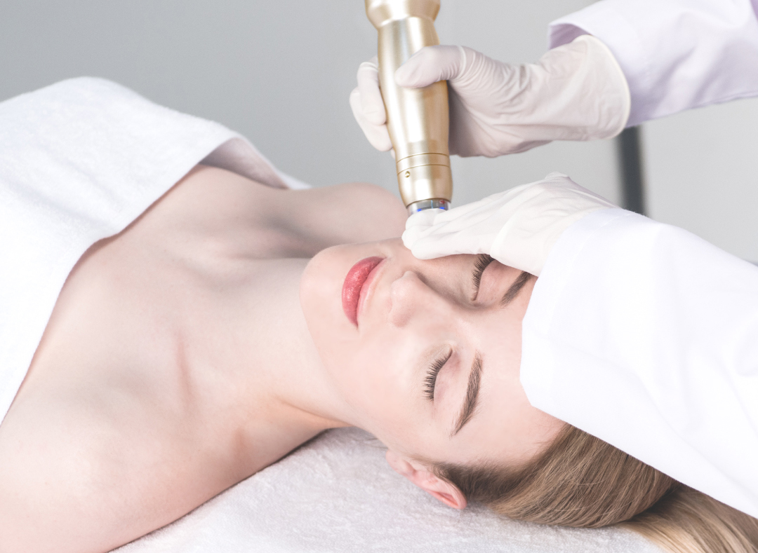 Sylfirm X treatment at Total Body Aesthetic med spa Los Angeles
