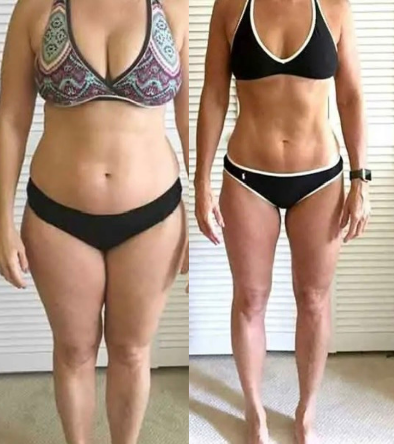 Weight loss before and after results in Westchester Los Angeles