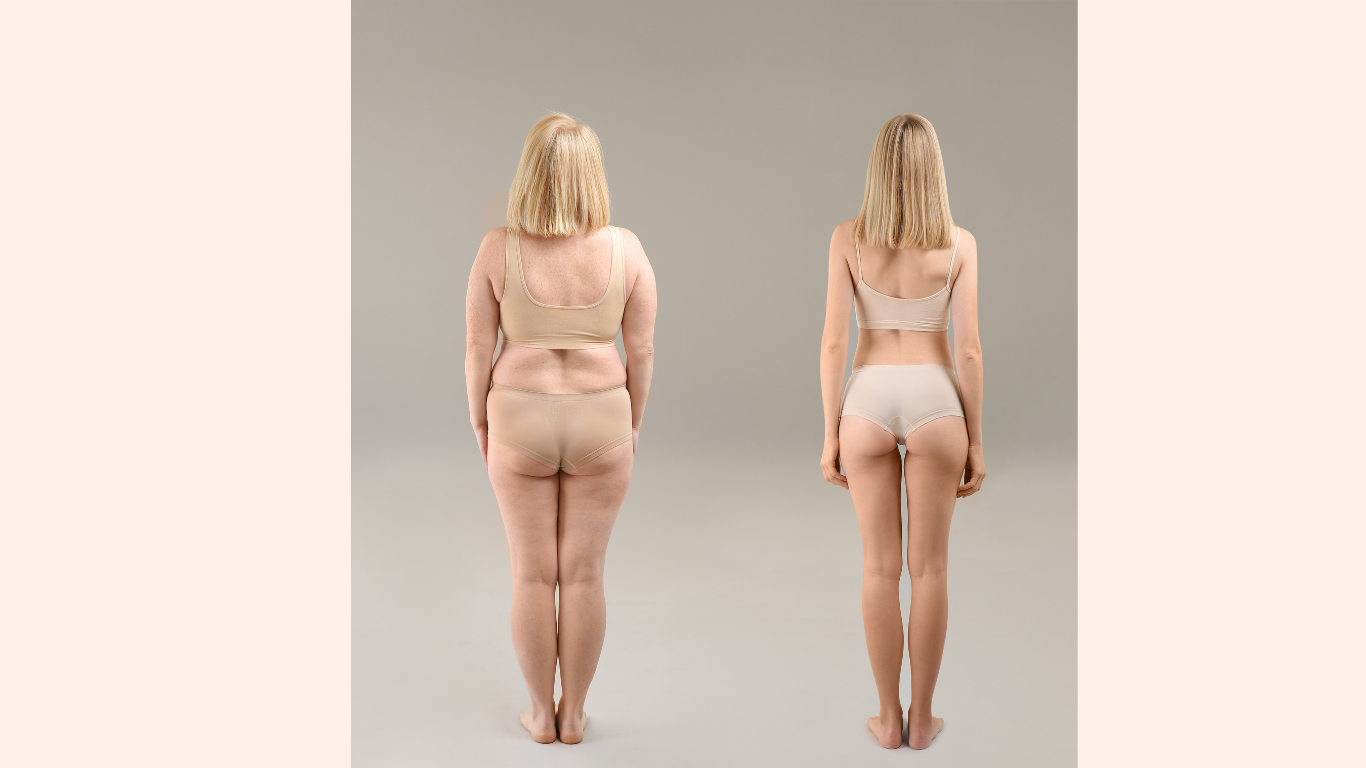 Weight loss before and after results in Los Angeles 90045